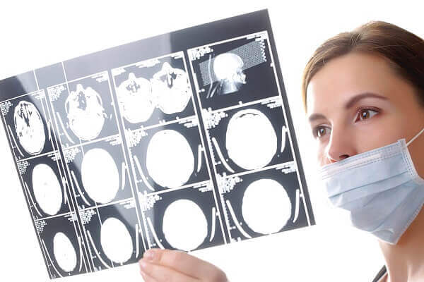 What is a Traumatic Brain Injury (TBI)?